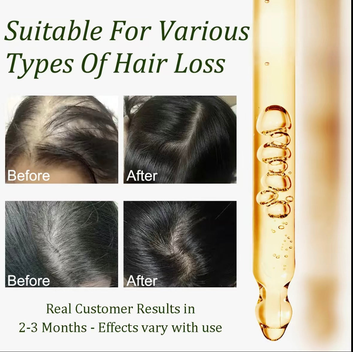 Lewedo Naturals Batana Oil Fast Hair Growth for Men Women Pure Batana Oil Nourish Shiny Hair Healthy Hair Care Anti Hair Loss